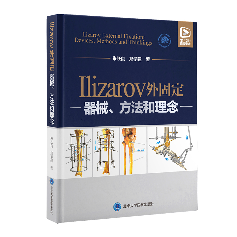 Ilizarov̶е