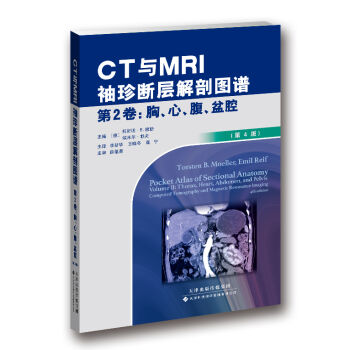 CTcMRIӽʈDV 2-ǻ