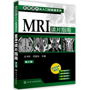 ӰxƬTͨϵ--MRIxƬָ(ڶ)(t(y)W(xu)ӰN(sh)(j)ٰ棬NRȫͣDƬጸԔM)